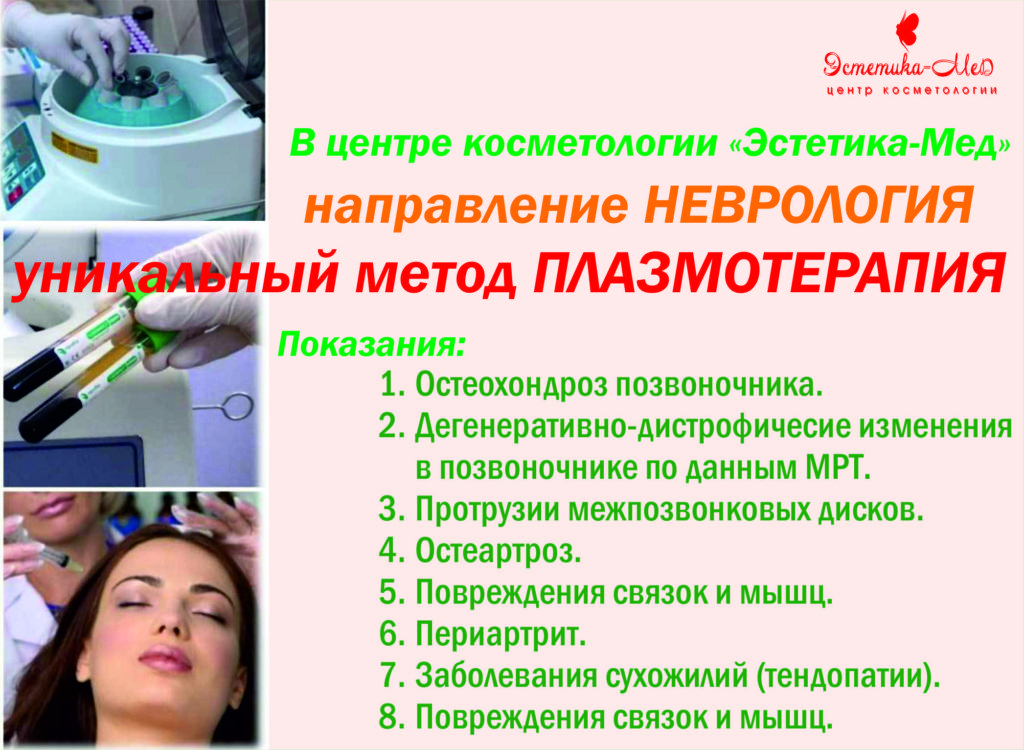Процедура плазмолифтинга для суставов. Плазмотерапия позвоночника. Плазмолифтинг позвоночника. Плазмотерапия в неврологии.